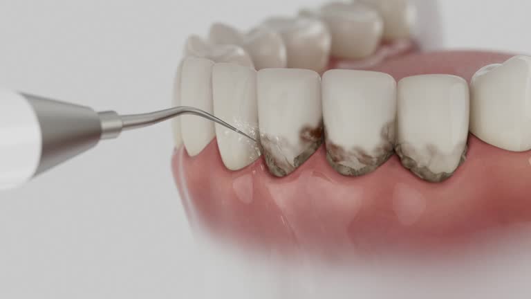 Reliable Dental Implants contractor in Yucaipa, CA by Smile Center Dentistry